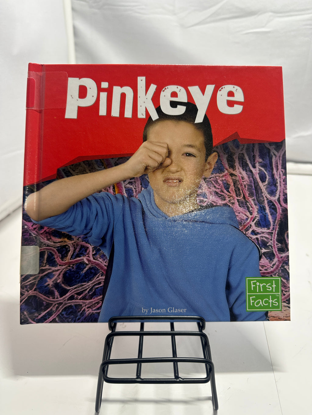 Pinkeye by Jason Glaser Hardcover