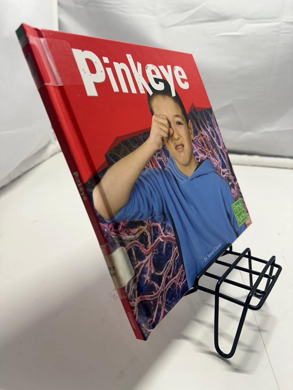 Pinkeye by Jason Glaser Hardcover